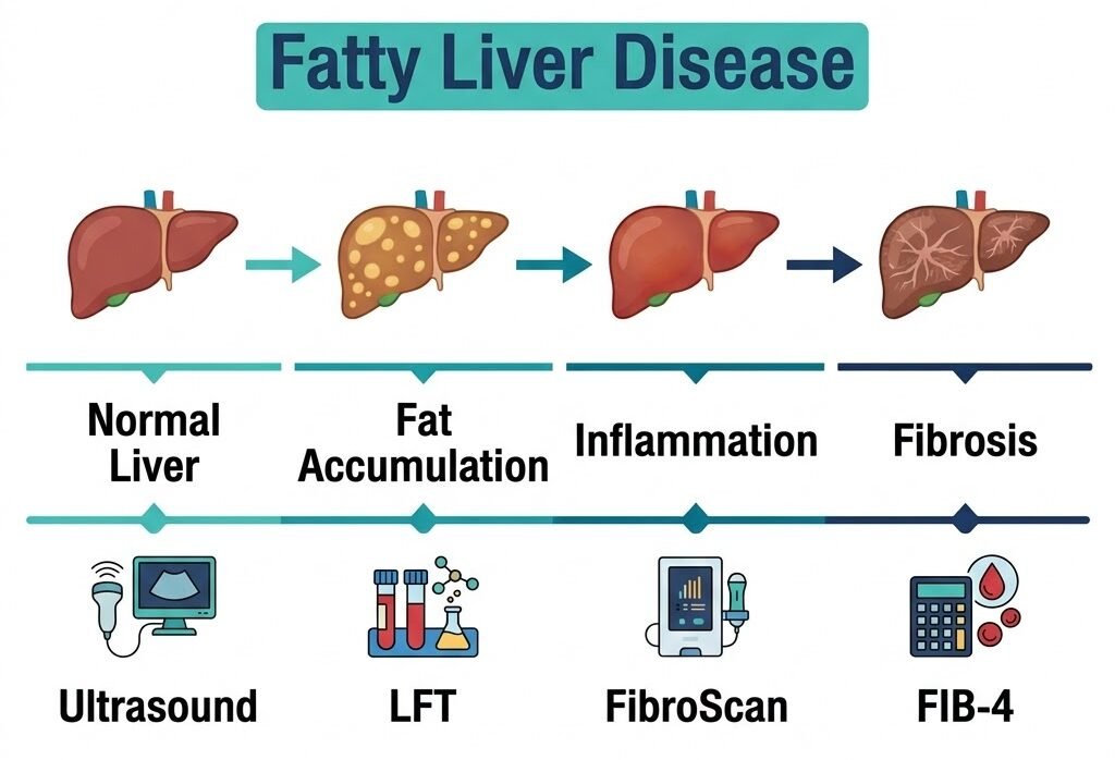 Fatty Liver: Symptoms, Causes, Grade 1, Tests, Diet & Treatment Diagram showing fatty liver progression stages and the tests used to assess them